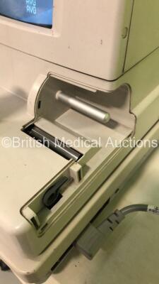 TopCon CT-80 Computerized Tonometer Version on Motorized Table (Powers Up - Missing Printer Trim) *S/N 1570425* **Mfd 2004** *FOR EXPORT OUT OF THE UK ONLY* - 4