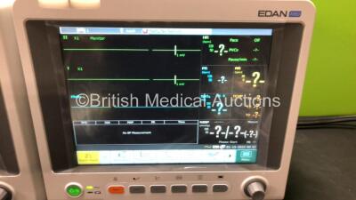 2 x EDAN iM60 Touch Screen Patient Monitors Including ECG, SpO2, NIBP, IBP1, IBP2, T1, T2 and CO2 Module Holder Options with 2 x Batteries, 2 x BP Hoses, 2 x BP Cuff, 2 x IBP Pressure Transducers, 2 x SpO2 Sensors, 2 x CO2 Sampling Lines, 2 x AC Power Cab - 2