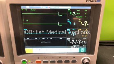 2 x EDAN iM60 Touch Screen Patient Monitors Including ECG, SpO2, NIBP, IBP1, IBP2, T1, T2 and CO2 Module Holder Options with 2 x Batteries, 2 x BP Hoses, 2 x BP Cuff, 2 x IBP Pressure Transducers, 2 x SpO2 Sensors, 2 x CO2 Sampling Lines, 2 x AC Power Cab - 2