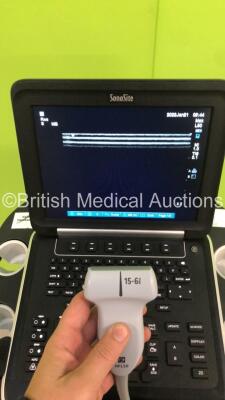 SonoSite Edge Portable Ultrasound Scanner Ref P15000-11 *S/N 03NNBV* **Mfd 02/2010** Boot Version 55.80.102.024 ARM Version 55.80.102.026 with 1 x Transducer / Probe (HFL50x/15-6 MHz Ref P07693-70 *Mfd 2016*) on SonoSite Cart (Powers Up) - 5