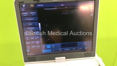 Toshiba Viamo Flat Screen Ultrasound Scanner SSA-640A *S/N E1D1022472** **Mfd 02/2010 ** Software Version 2.2.500 with 1 x Transducer / Probe (PLT-1204BT *Mfd 05/2010*) and Sony UP-D897 Digital Graphic Printer (Powers Up) - 6