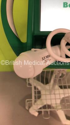 BARD Bardscan IIs Bladder Scanner on Stand with Power Supply and Probe (Powers Up) * SN 02346 * - 3