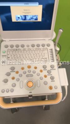 Philips CX50 Portable Ultrasound Scanner Ref 453561414281 *S/N SG11000254* **Mfd 02/2010** Version 3.1.2 with 1 x Transducer / Probe (C9-3v) and Sony UP-D897 Digital Graphic Printer (Powers Up - Cracks to Unit - See Pictures) ***IR336*** - 4