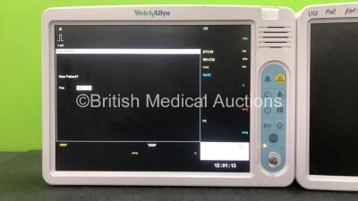 2 x Welch Allyn 1500 Patient Monitors (1 Powers Up, 1 No Power, Both with Missing Dials-See Photos) *SN 79100922, 79100829* - 2