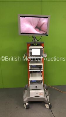 Smith and Nephew Stack Trolley with Sony Monitor, Smith and Nephew 560P High Definition Camera System, Smith and Nephew 560H Camera Ref 72200561, Smith and Nephew 660HD Image Management System, Smith and Nephew 500XL Xenon Light Source and Sony Printer (P