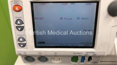 GE 250cx Series Fetal Monitor on Stand with 2 x US and 1 x Toco Transducers (Powers Up) *S/N 259CX-A* - 2