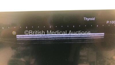 Hitachi Hi-Vision Ascendus Flat Screen Ultrasound Scanner *S/N G300007714* **Mfd 2014** Software Version V07-01 Step 4 with 5 x Transducers / Probes (EUP-V53W *Mfd 06/2009* / EUP-L65 *Mfd 06/2010* / EUP-C715 / EUP-L73S *Mfd 02/2009* and EUP-L52 *Mfd 09/2 - 8