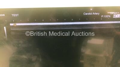 Hitachi Hi-Vision Ascendus Flat Screen Ultrasound Scanner *S/N G300007714* **Mfd 2014** Software Version V07-01 Step 4 with 5 x Transducers / Probes (EUP-V53W *Mfd 06/2009* / EUP-L65 *Mfd 06/2010* / EUP-C715 / EUP-L73S *Mfd 02/2009* and EUP-L52 *Mfd 09/2 - 12