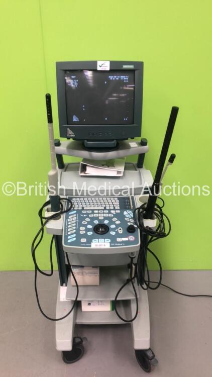 BK Medical 2102 Hawk Ultrasound Scanner *S/N 2005-1854669* with 3 x Transducers / Probes (Type 8008 5-10 MHz / Type 2052 and Type 1850) and Sony UP-895MD Colour Video Printer (Powers Up) ***IR444***