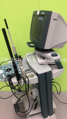 BK Medical 2102 Hawk Ultrasound Scanner *S/N 2005-1854669* with 3 x Transducers / Probes (Type 8008 5-10 MHz / Type 2052 and Type 1850) and Sony UP-895MD Colour Video Printer (Powers Up) ***IR444*** - 6