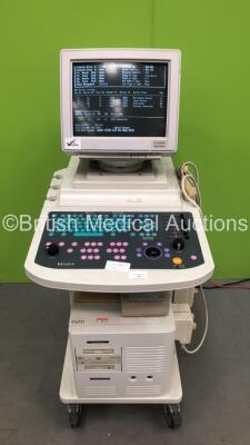 Diasus Dynamic Imaging Ultrasound Scanner *S/N 03-6925* with 3 x Transducers / Probes (P755HF01 5-10 MHz / P12LHF02 8-16MHz and P16LFH02 10-22 MHz) and Sony UP-D895MD Digital Graphic Printer (HDD REMOVED)