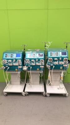 3 x Gambro AK 200 Ultra S Dialysis Machines Software Version 11.11 with Hoses (All Power Up) *S/N 25564 / 20887 / 16574*