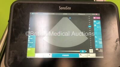 SonoSite X-Porte Ultrasound Scanner Ref P14027-15 *S/N 281502529* **Mfd 07/2015** Software Version 70.80.107.014 Transducer Package Version 70.80.106.006 SH Database Version 70.80.105.026 with 3 x Transducers / Probes (P21xp/5-1 MHz Ref P14563-20 *Mfd 08/ - 2