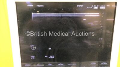 Hitachi Hi-Vision Preirus Flat Screen Ultrasound Scanner *S/N G310103114* **Mfd 2014** with 2 x Transducers / Probes (EUP-C715 *Mfd 2014-11* and EUP-L74M *Mfd 2009-03*) and Sony UP-D897 Digital Graphic Printer (Powers Up) - 5