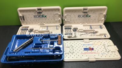 2 x Mitek Rigidfix Sets in Trays and 1 x Johnson&Johnson Orthopaedics SmartSet (All Incomplete)