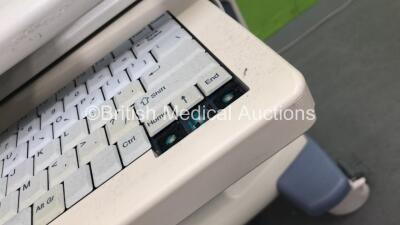 Aloka Prosound Alpha 7 Ultrasound Scanner *Mfd 2010* with 1 x Sony UP-D897 Printer (Powers Up with Missing Casing and Keys - See Photo) *200A4812* - 5