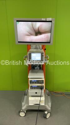 Smith and Nephew Stack Trolley with Sony Monitor, Smith and Nephew 660HD Image Management System, Smith and Nephew 500XL Light Source, Smith and Nephew 560P High Definition Camera System, Smith and Nephew 560H Camera Head and Sony UP-DR80MD Digital Colour