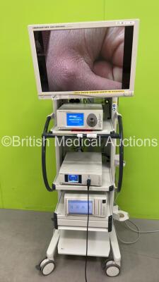 Stryker Stack System with Stryker Vision Elect HDTV Surgical Monitor, Stryker Pneumo Sure High Flow Insufflator, Stryker 1288HD High Definition Camera Control Unit, Stryker 1288HD Camera Head and Stryker SDC Ultra HD Information Management System (Powers 