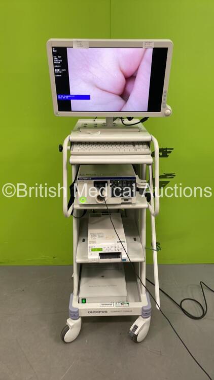 Olympus Stack Trolley with Advan Monitor, Olympus CV-170 Surgical Imaging Platform, Olympus OTV-S7H Camera Head (Showing Error E311)and Sony UP-25MD Colour Video Printer (Powers Up)