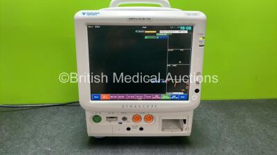 ukuda Denshi Dynascope DS-7200 Patient Monitor Including ECG, SpO2, C02, NIBP, BP1, BP2, T1, T2 and Printer Options (Powers Up with Missing Printer Cover-See Photo) *SN 50000248*