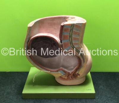 Pregnancy Pelvis Anatomical Model (Missing Removable Foetus)