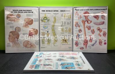 4 x Anatomical Charts