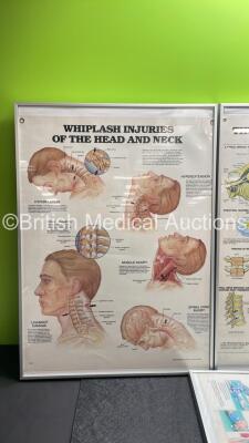 4 x Anatomical Charts - 2