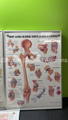 4 x Anatomical Charts - 4