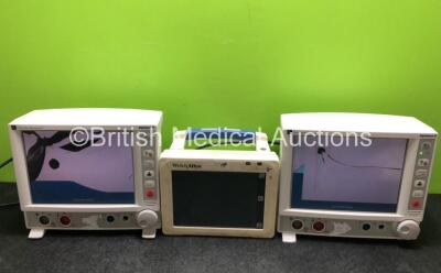 Job Lot Including 2 x Edwards Lifesciences Vigilance II Patient Monitors (Both Power Up with Damage to Screen and Casing - See Photos) and 1 x Welch Allyn Model 242 Patient Monitor (Damage to Casing - See Photos)