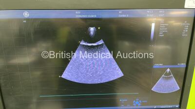 GE Vivid E95 Flat Screen Ultrasound Scanner Ref #1 GC000220 / #2 H45581DA Application SW Version 204 System SW Version 204.15.3 with 4 x Transducer/Probes (6S-D *Mfd 2016-10* / 4V-D *Refurbished 2015* / M5Sc-D *Mfd 2021-04* and Pencil Probe) * SN AU01548 - 12