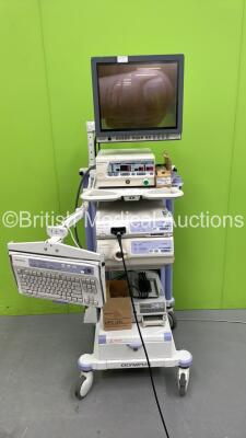 Olympus Stack Trolley with Olympus OEV191H Monitor, Olympus OES UHI-3 Insufflator, Olympus Evis Exera II CV-180 Camera Control Unit, Olympus OTV-SP1H Camera Head, Olympus Evis Exera II CLV-180 Light Source and Sony UP-21MD Colour Video Printer (Powers Up)