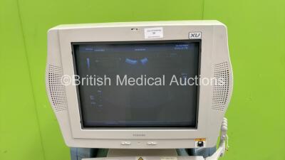 Toshiba Aplio XV SSA-770A Ultrasound Scanner *S/N 80G0593780* **Mfd 09/2005** with 1 x Transducer/Probe (PVT-375BT * Mfd Feb 2015 *) and Sony UP-D895 Digital Graphic Printer (Powers Up - Damage to Casing - See Pictures) - 2