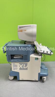 Toshiba Aplio XV SSA-770A Ultrasound Scanner *S/N 80G0593780* **Mfd 09/2005** with 1 x Transducer/Probe (PVT-375BT * Mfd Feb 2015 *) and Sony UP-D895 Digital Graphic Printer (Powers Up - Damage to Casing - See Pictures) - 11