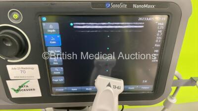 SonoSite NanoMaxx Portable Ultrasound Scanner Ref P11111-45 *S/N 03R6Z8* **Mfd 10/2012** Boot Version 60.80.101.032 ARM Version 60.80.101.032 with 1 x Transducer / Probe (Ln25/13-6 MHz Ref P12092-11 *Mfd 08/2012*) on SonoSite Stand (Powers Up) - 8