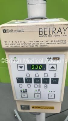 Belmont Belray Model 96 Dental X-Ray Timer on Stand with Belmont X-Ray Head Model 096-H (Powers Up with Some Casing Damage - See Photo) - 2