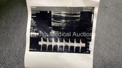 Philips L12-3 Ultrasound Transducer / Probe for Philips CX50 *See Photo for Airscan* in Box - 5