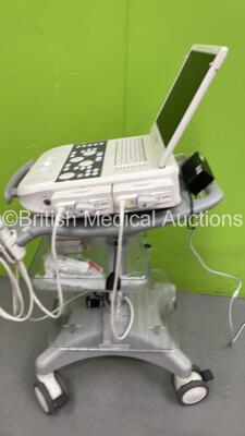 Siemens Acuson P300 Flat Screen Portable Ultrasound Scanner Model No 10852646 *S/N 2149* **Mfd 09/2015** Software Rev 1.01 STD 13.21 with 2 x Transducers / Probes (CA431 and LA435 - Both Head Damage - See Photos) on Stand (Powers Up) ***IR393*** - 4