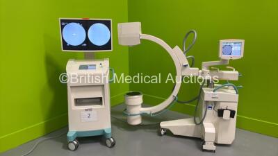 Ziehm Imaging Ziehm Vision C-Arm *Mfd - May 2016* with Dual Flat Screen Image Intensifier, Exposure Trigger, Footswitch and Key (Powers Up and Exposure Taken) *91869*