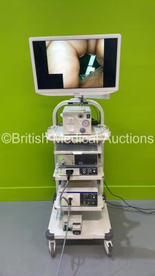 Olympus Stack Trolley with Sony LCD Monitor(Some Marks to Screen - See Photo) Keyboard, Olympus UHI-4 Insufflation Unit, Olympus Visera Elite OTV-S190 Video Processor, Olympus Endoeye WA50042A, Olympus Visera Elite CLV-S190 Light Source, Olympus KV-5 Suct