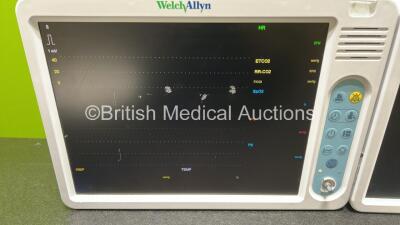 2 x Welch Allyn 1500 Patient Monitors with (Both Power Up, Both Missing Dials, Minor Cracked Casings and Scratched Screens-See Photos) *SN 791.00936 / 791.00830* - 3